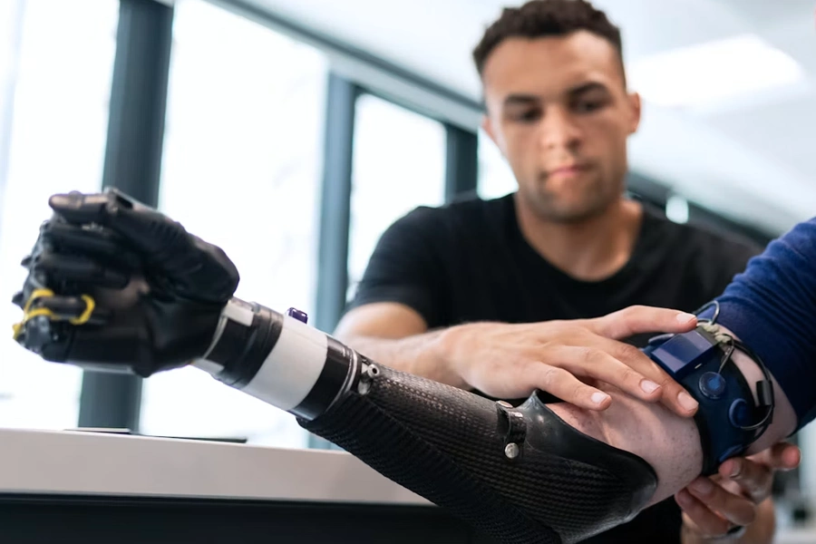A man's arm rests near a black carbon-fiber myoelectric prosthetic hand and forearm, while another person adjusts a sensor device strapped to his forearm, likely calibrating the prosthesis in a clinical or lab setting.